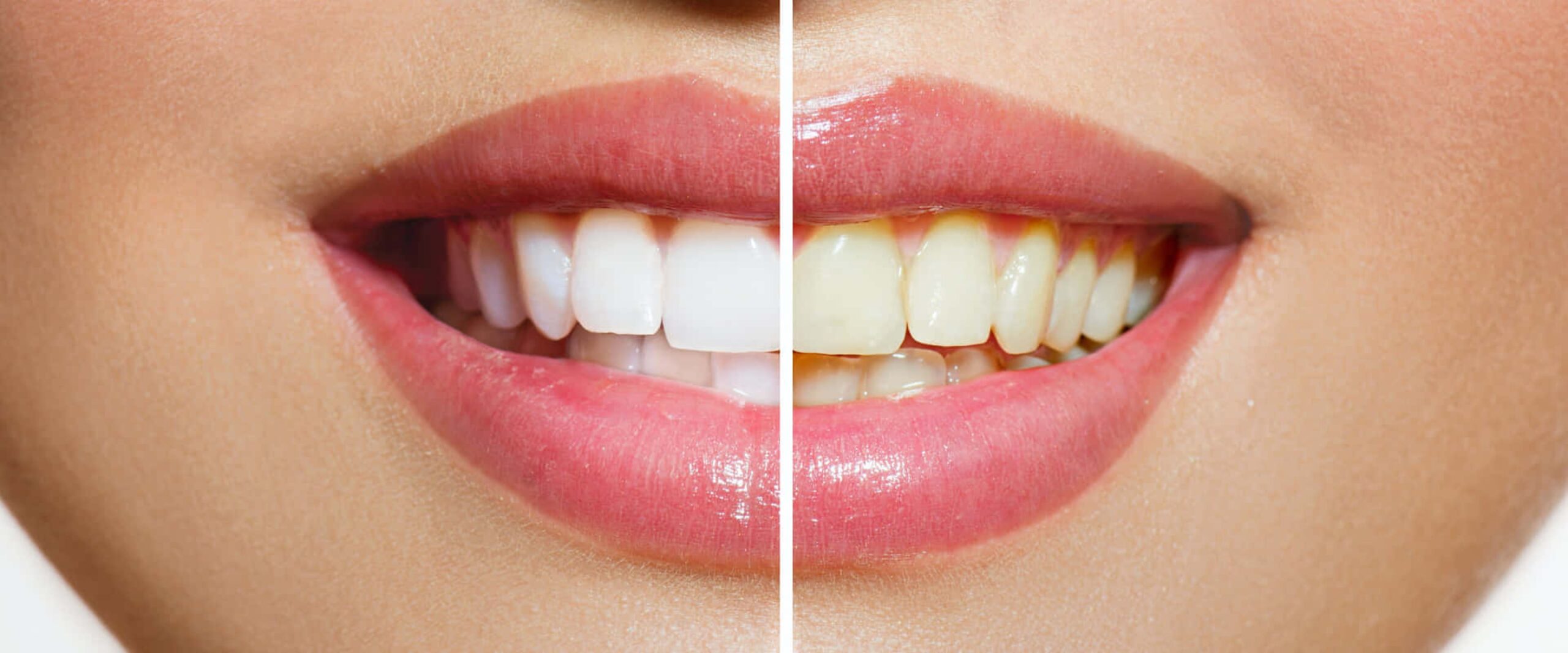 Douglas Moura - www.drdouglasmoura.com.br - Postagem no Blog - 002