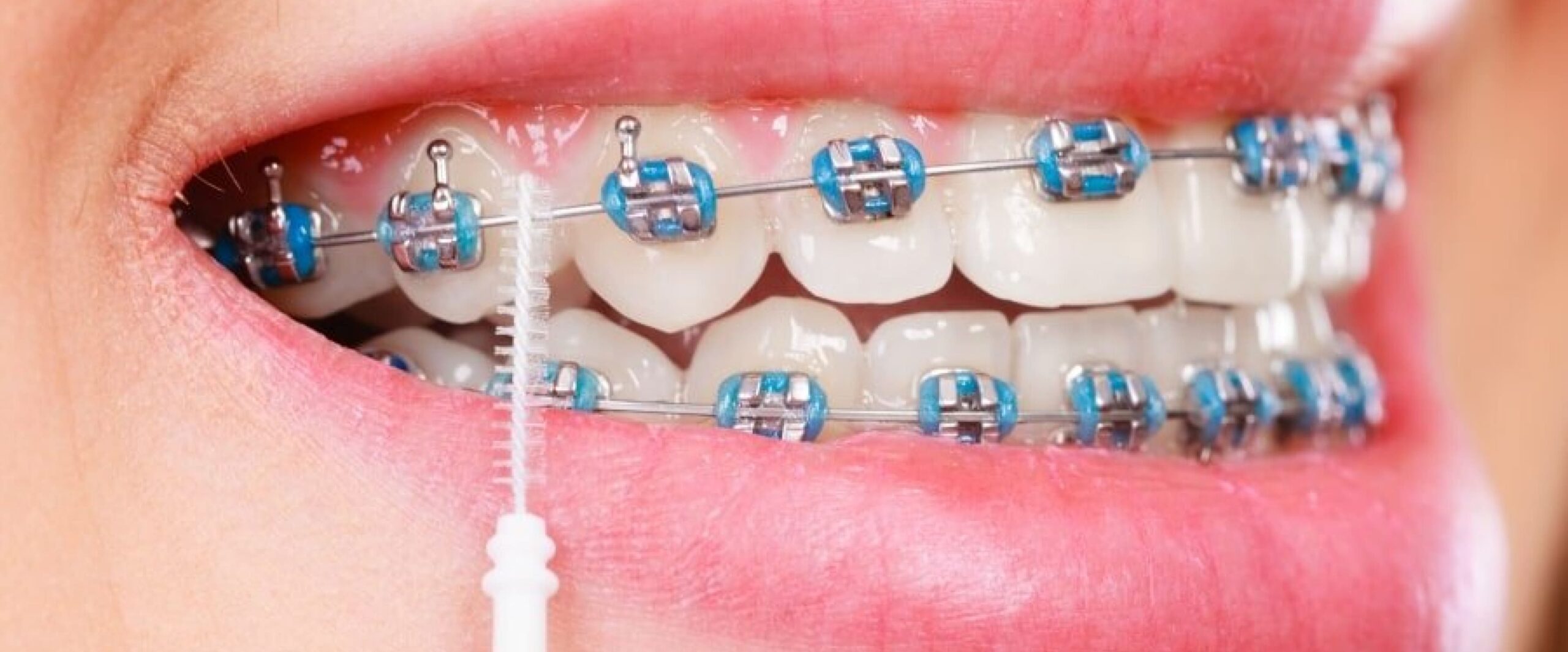 Douglas Moura - www.drdouglasmoura.com.br - Postagem no Blog - 004