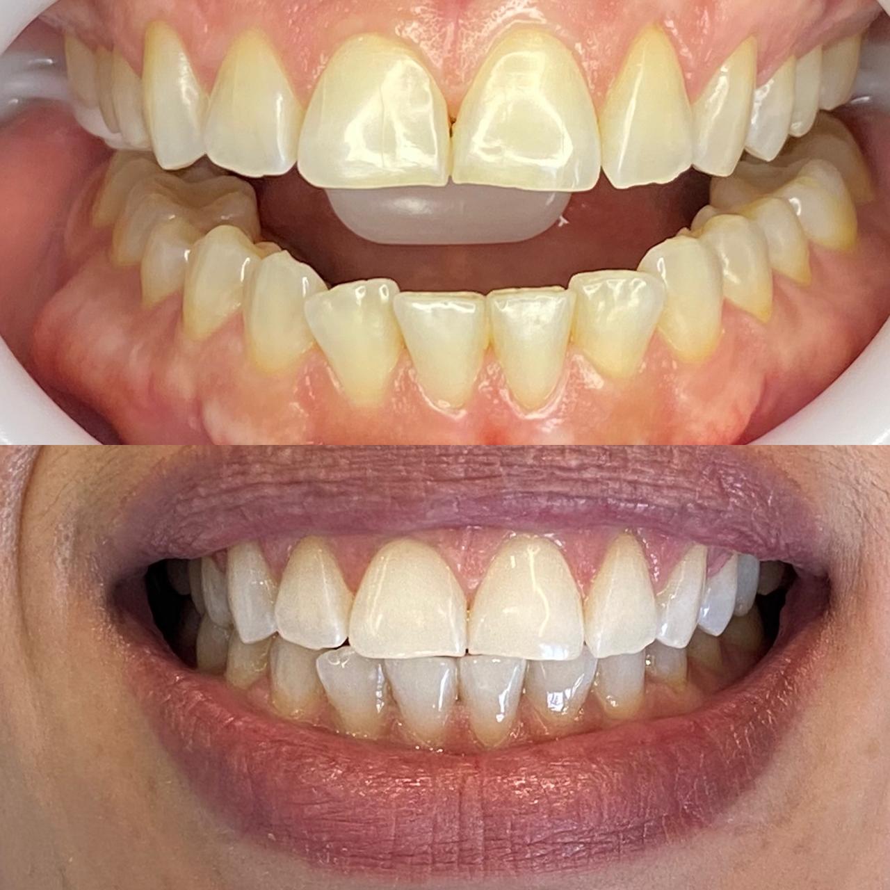 Dr. Douglas Moura - Resultados de tratamentos - 01