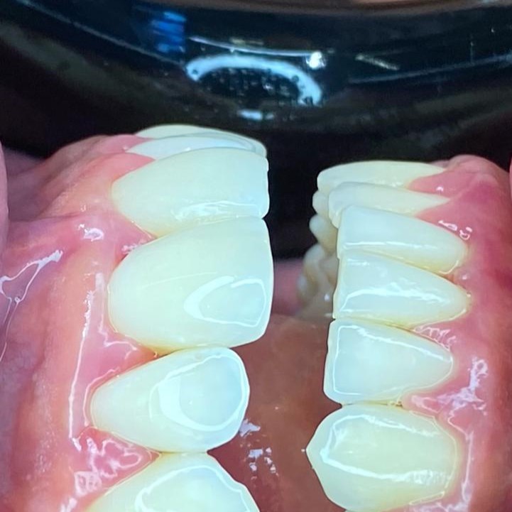 Dr. Douglas Moura - Resultados de tratamentos - 02