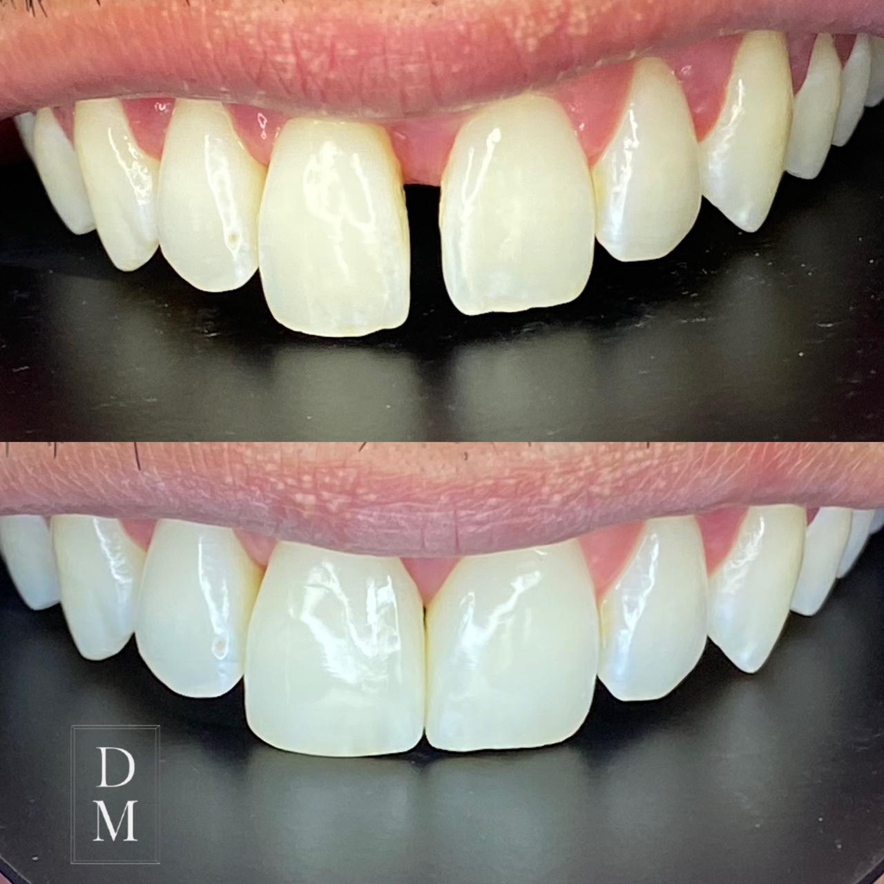 Dr. Douglas Moura - Resultados de tratamentos - 03