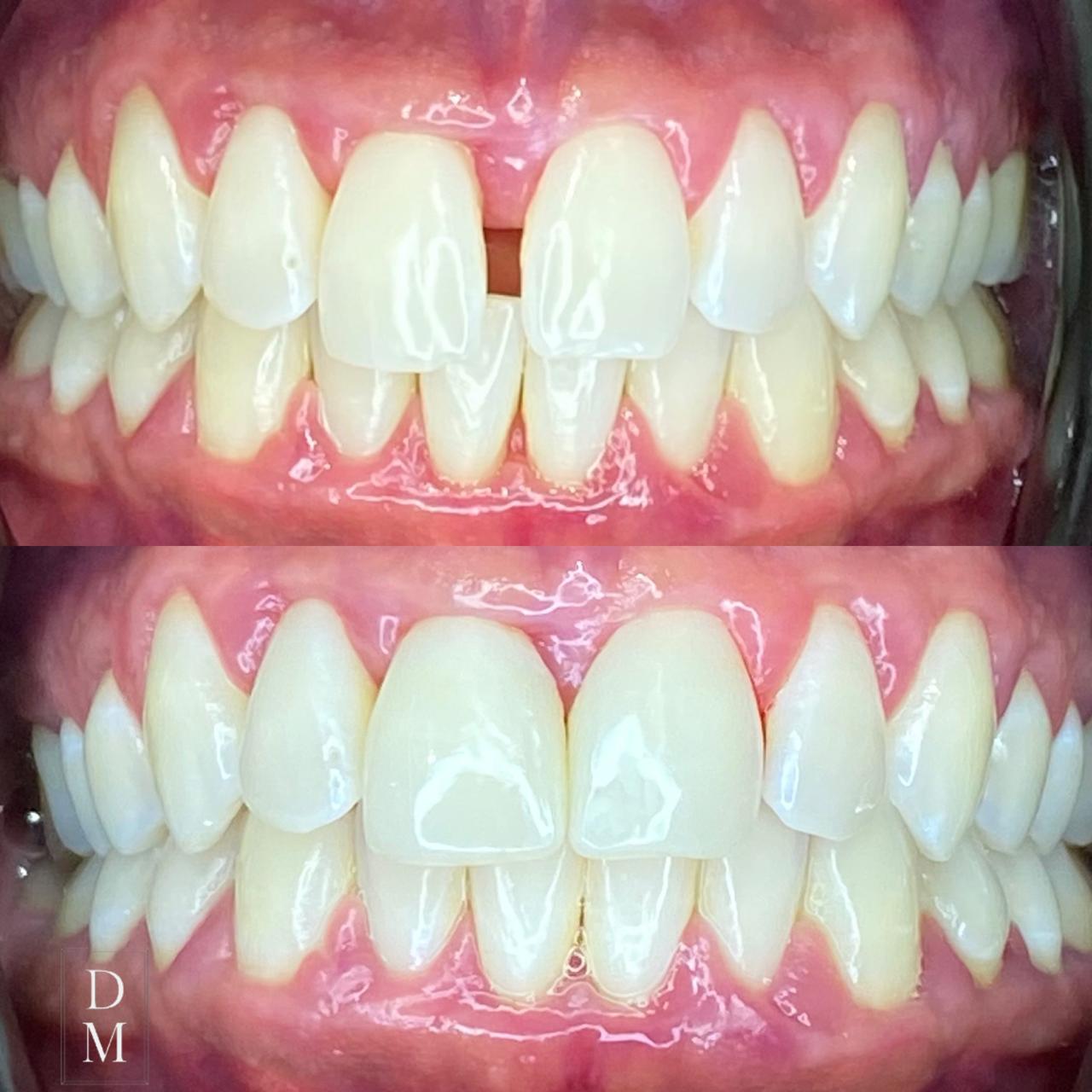 Dr. Douglas Moura - Resultados de tratamentos - 04