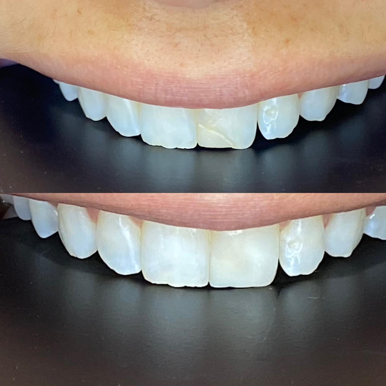 Dr. Douglas Moura - Resultados de tratamentos - 05