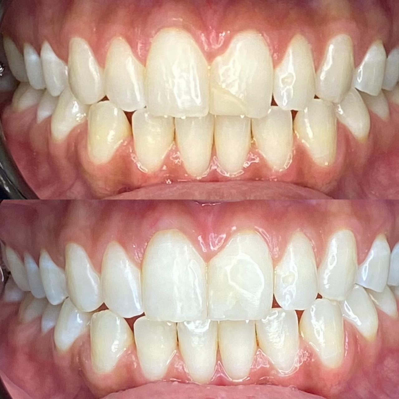 Dr. Douglas Moura - Resultados de tratamentos - 06