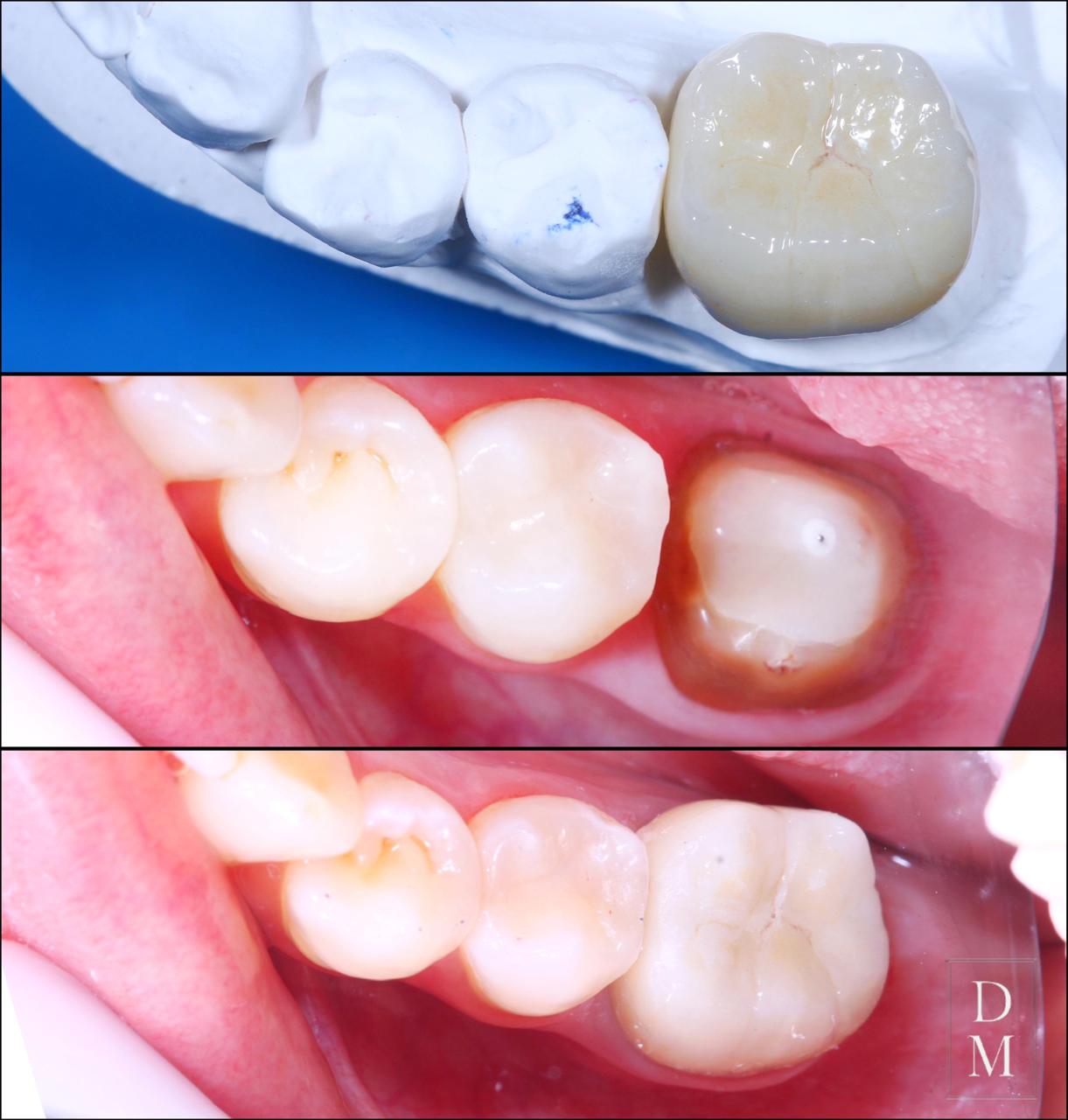 Dr. Douglas Moura - Resultados de tratamentos - 07