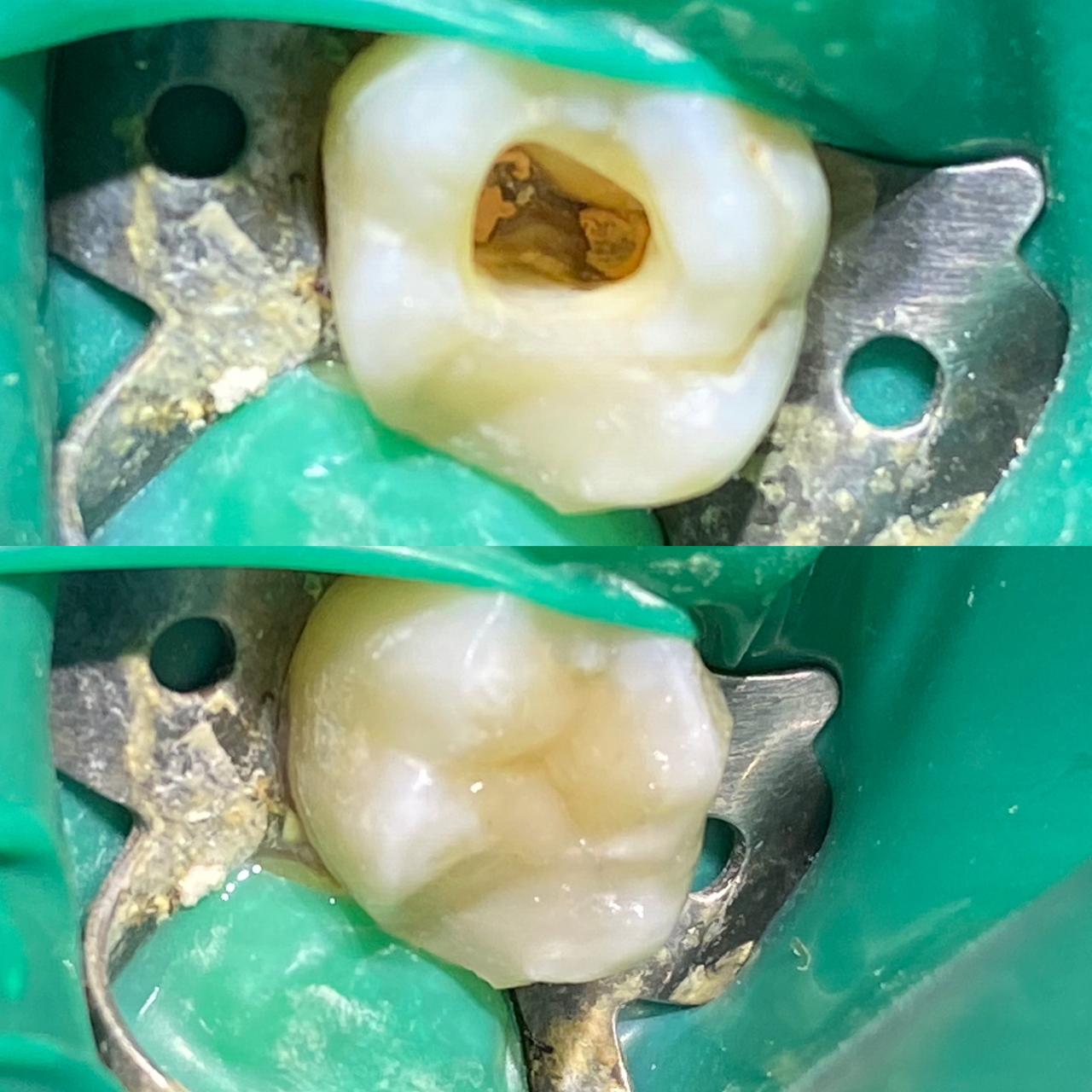 Dr. Douglas Moura - Resultados de tratamentos - 08