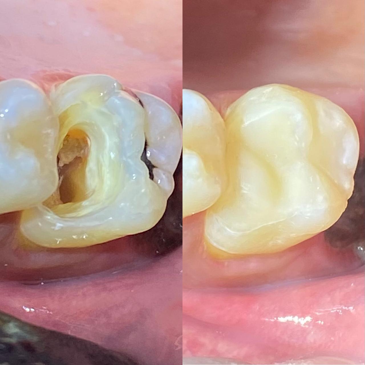 Dr. Douglas Moura - Resultados de tratamentos - 09