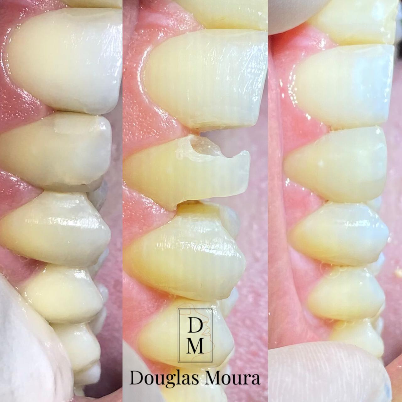 Dr. Douglas Moura - Resultados de tratamentos - 10