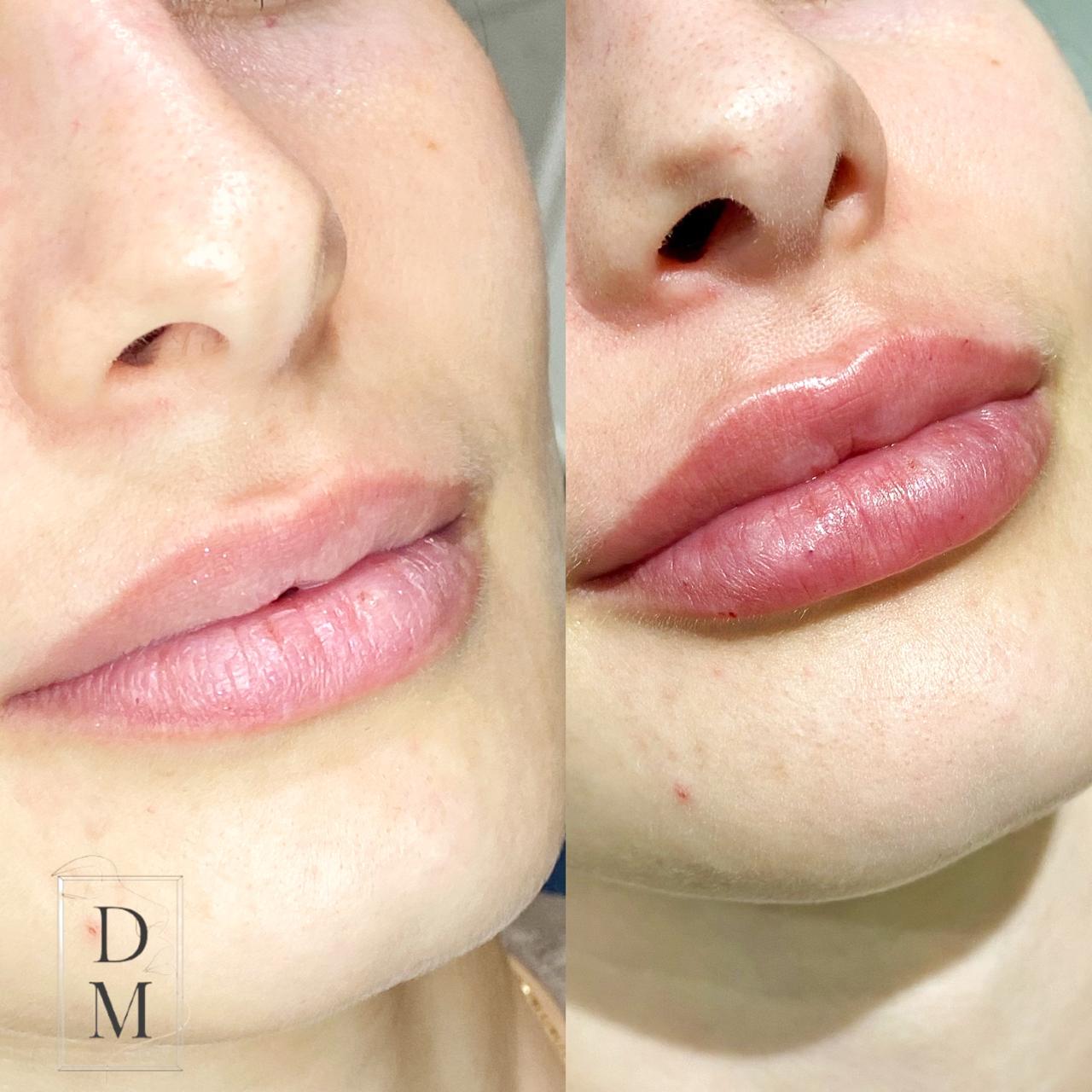 Dr. Douglas Moura - Resultados de tratamentos - 11