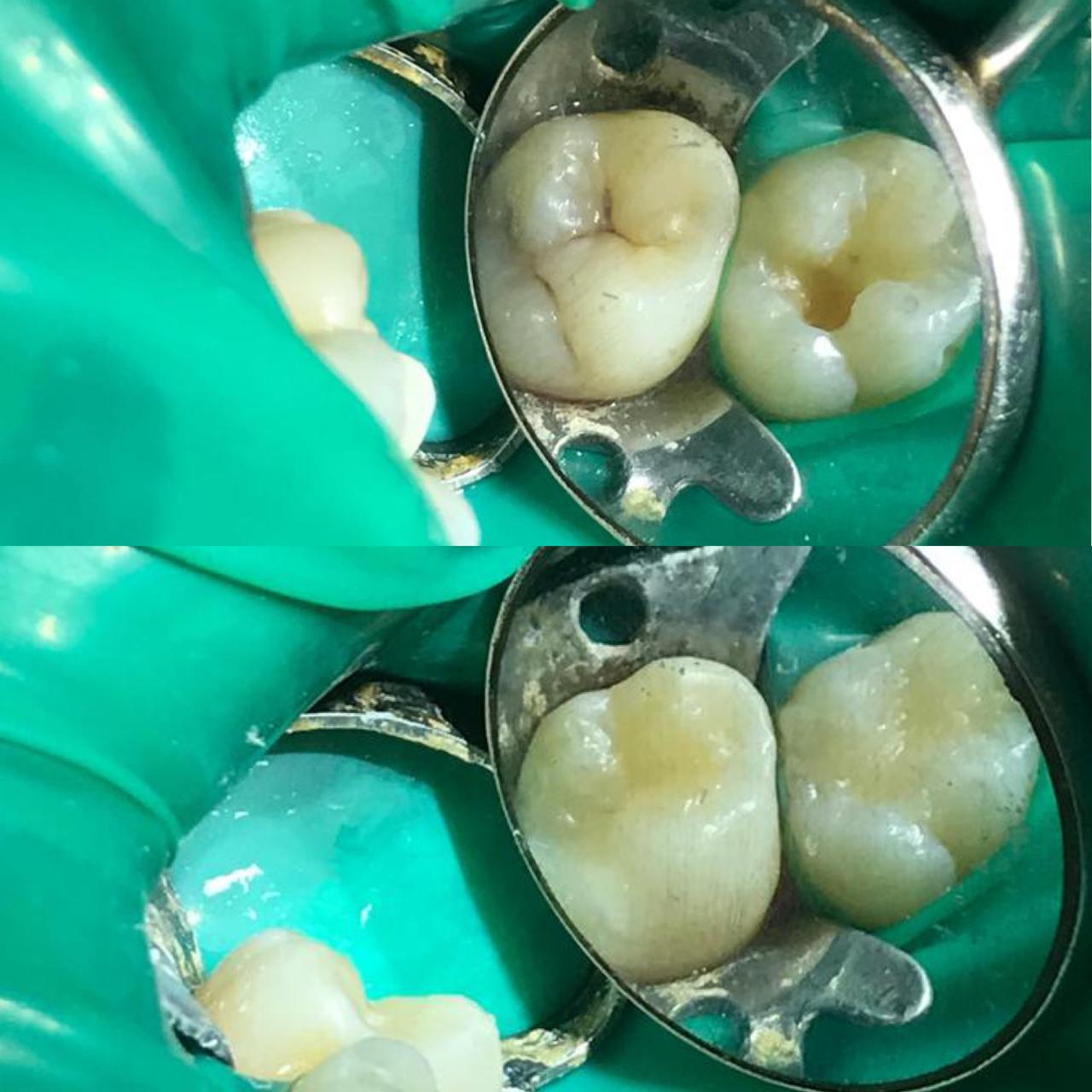 Dr. Douglas Moura - Resultados de tratamentos - 12
