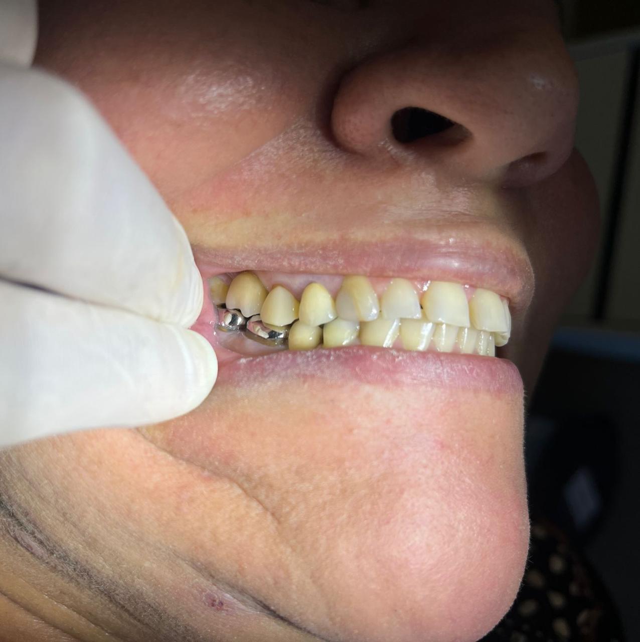 Dr. Douglas Moura - Resultados de tratamentos - 13