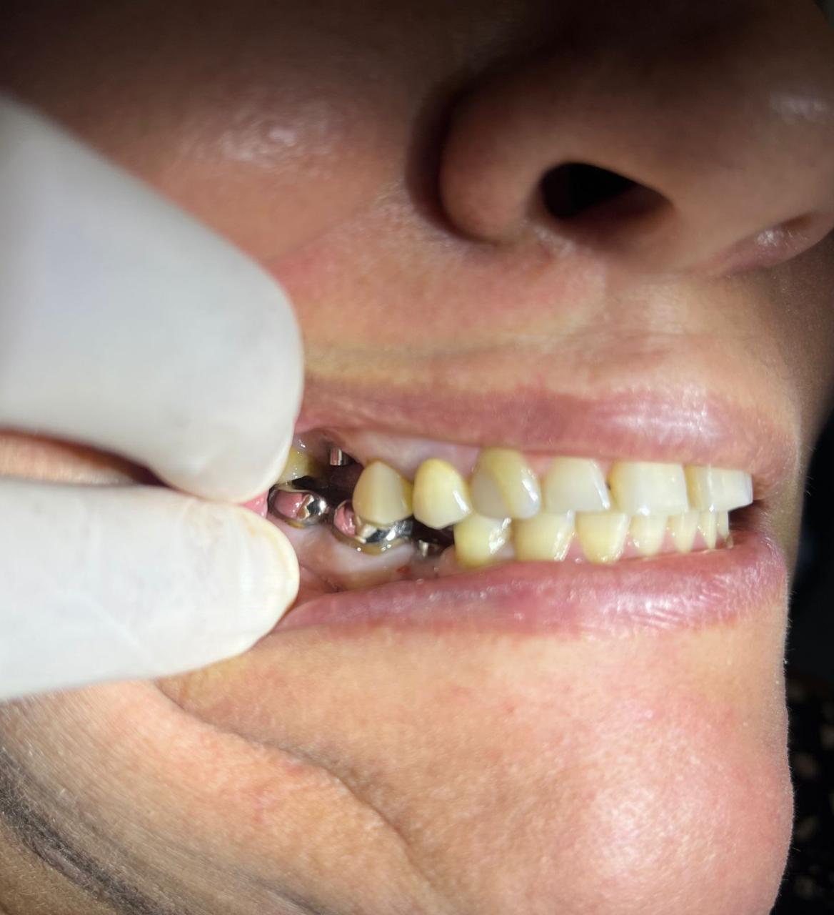 Dr. Douglas Moura - Resultados de tratamentos - 14