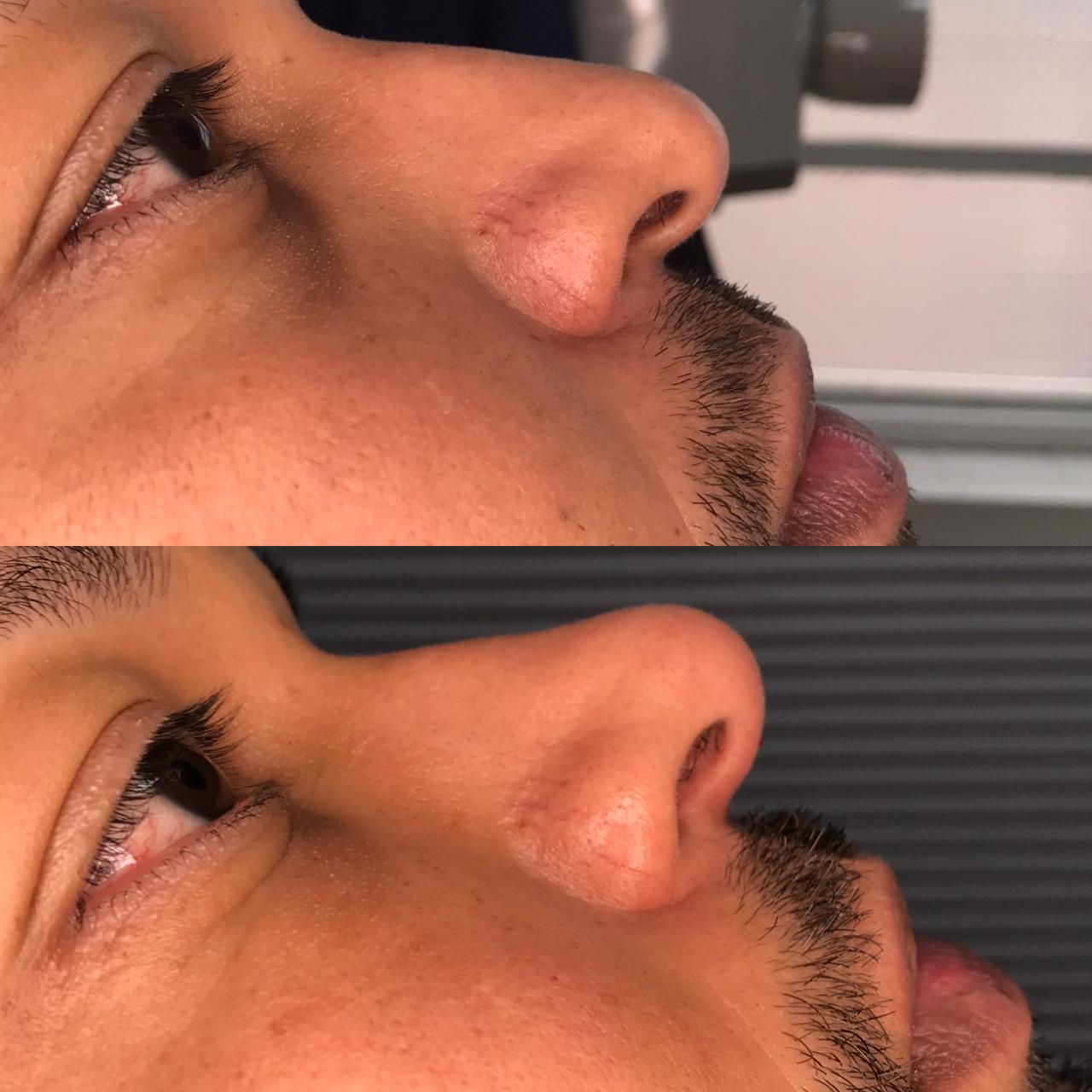 Dr. Douglas Moura - Resultados de tratamentos - 15