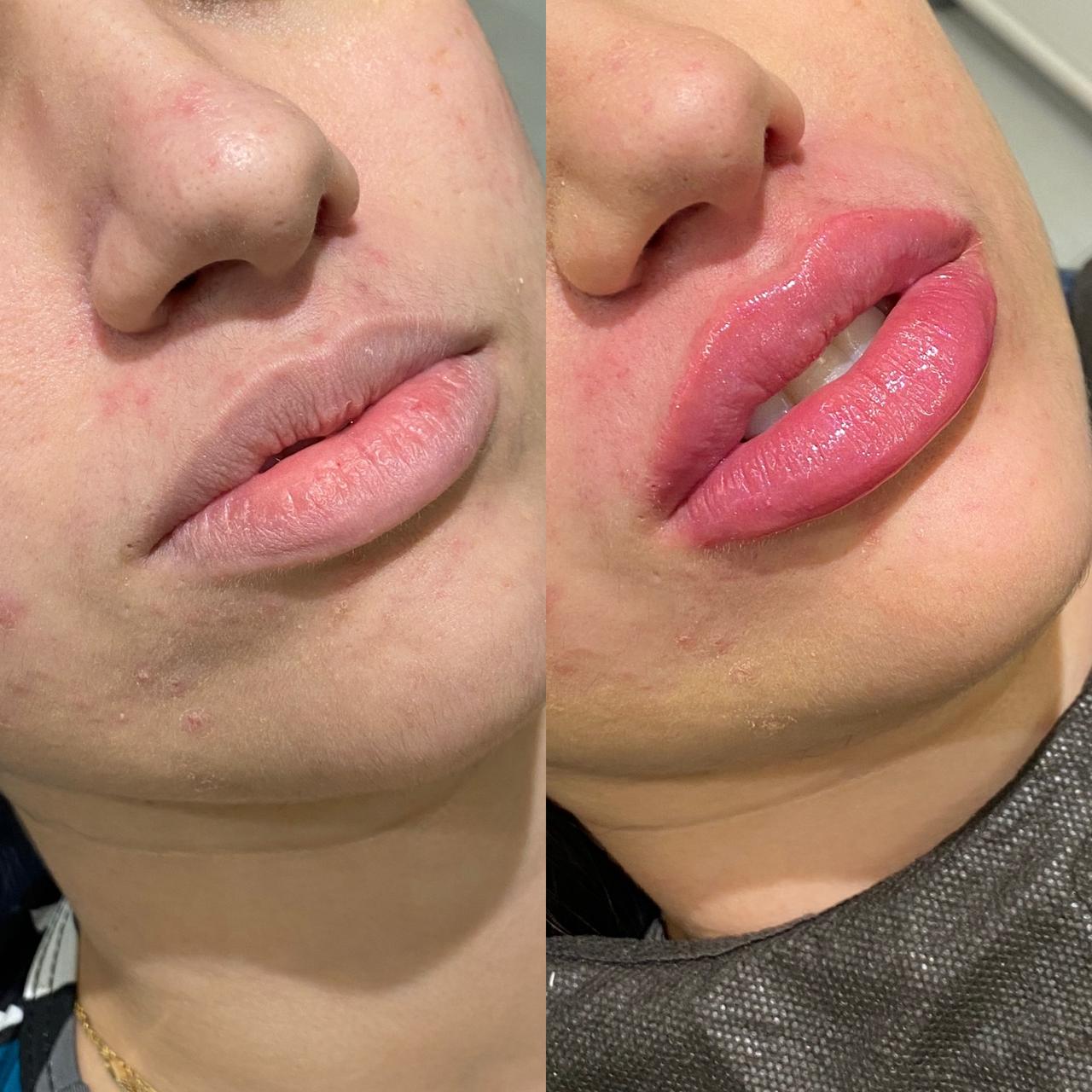 Dr. Douglas Moura - Resultados de tratamentos - 16