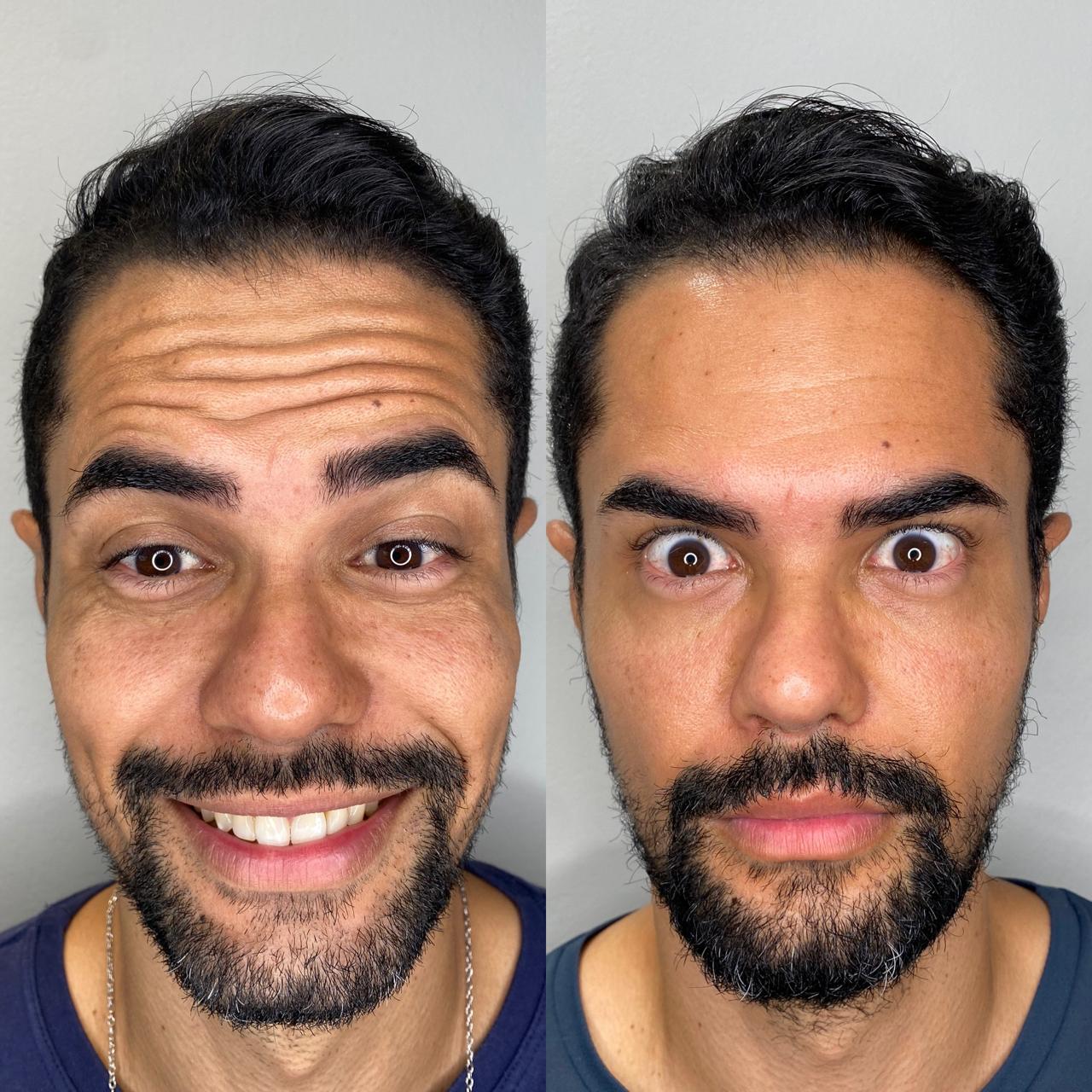 Dr. Douglas Moura - Resultados de tratamentos - 17