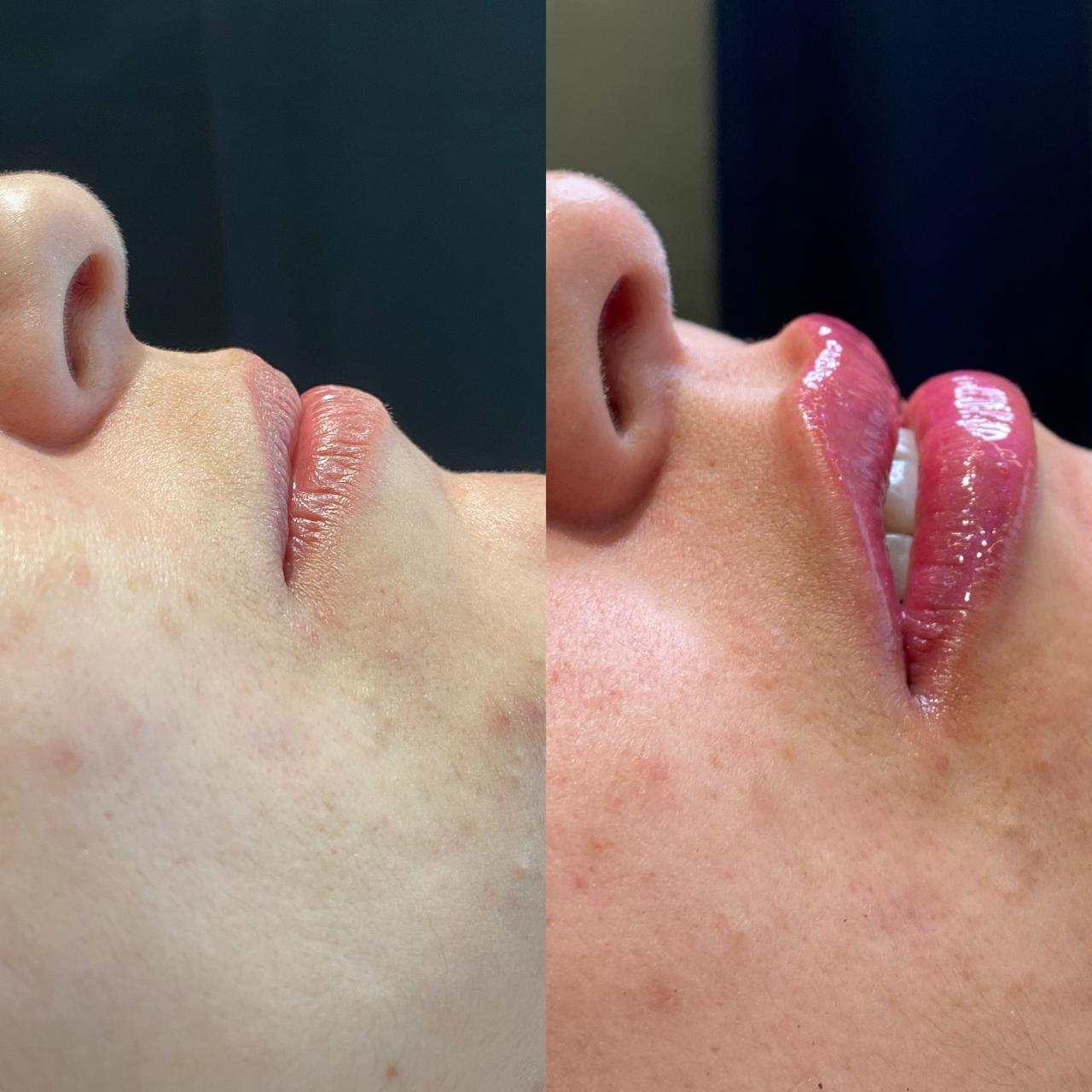 Dr. Douglas Moura - Resultados de tratamentos - 18