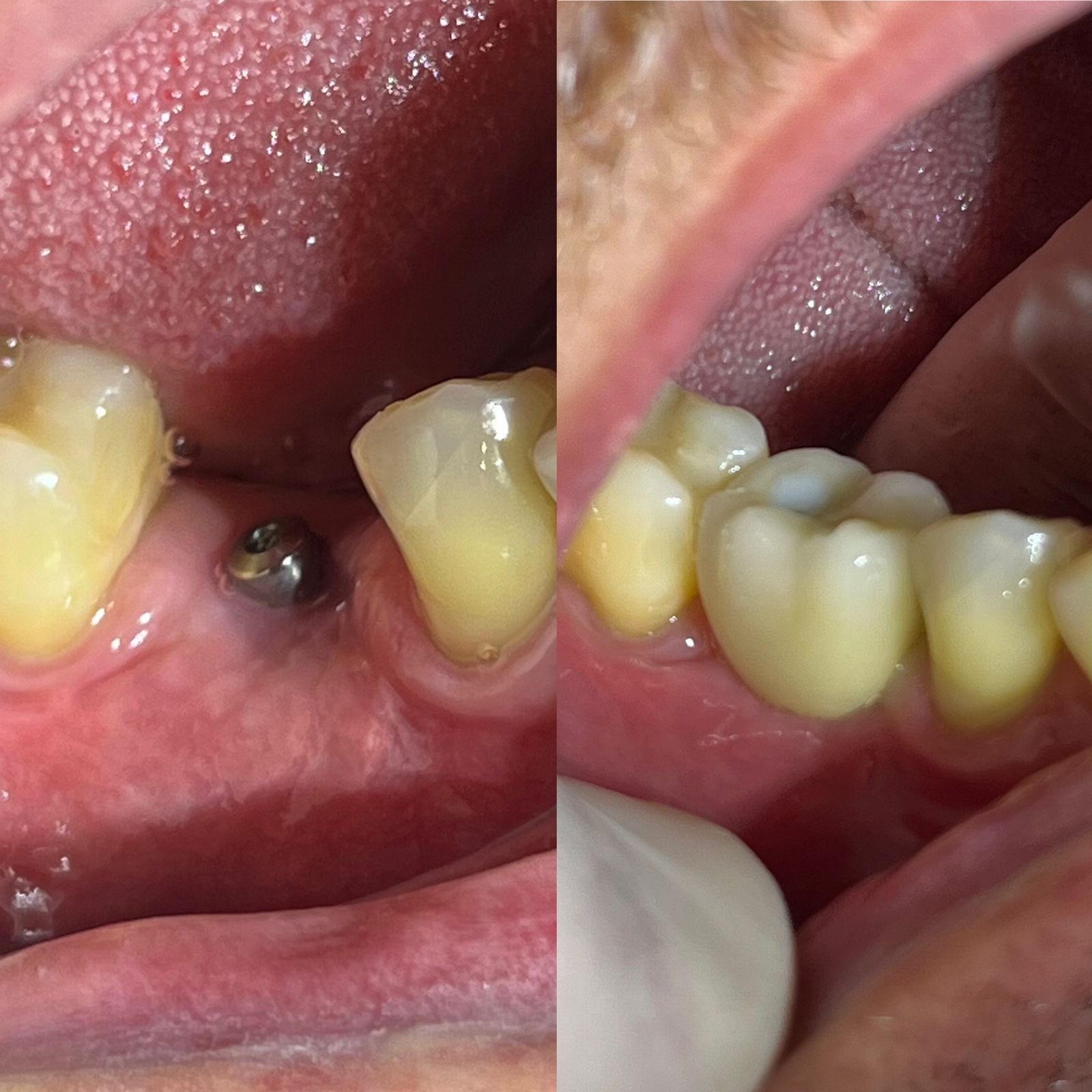 Dr. Douglas Moura - Resultados de tratamentos - 22
