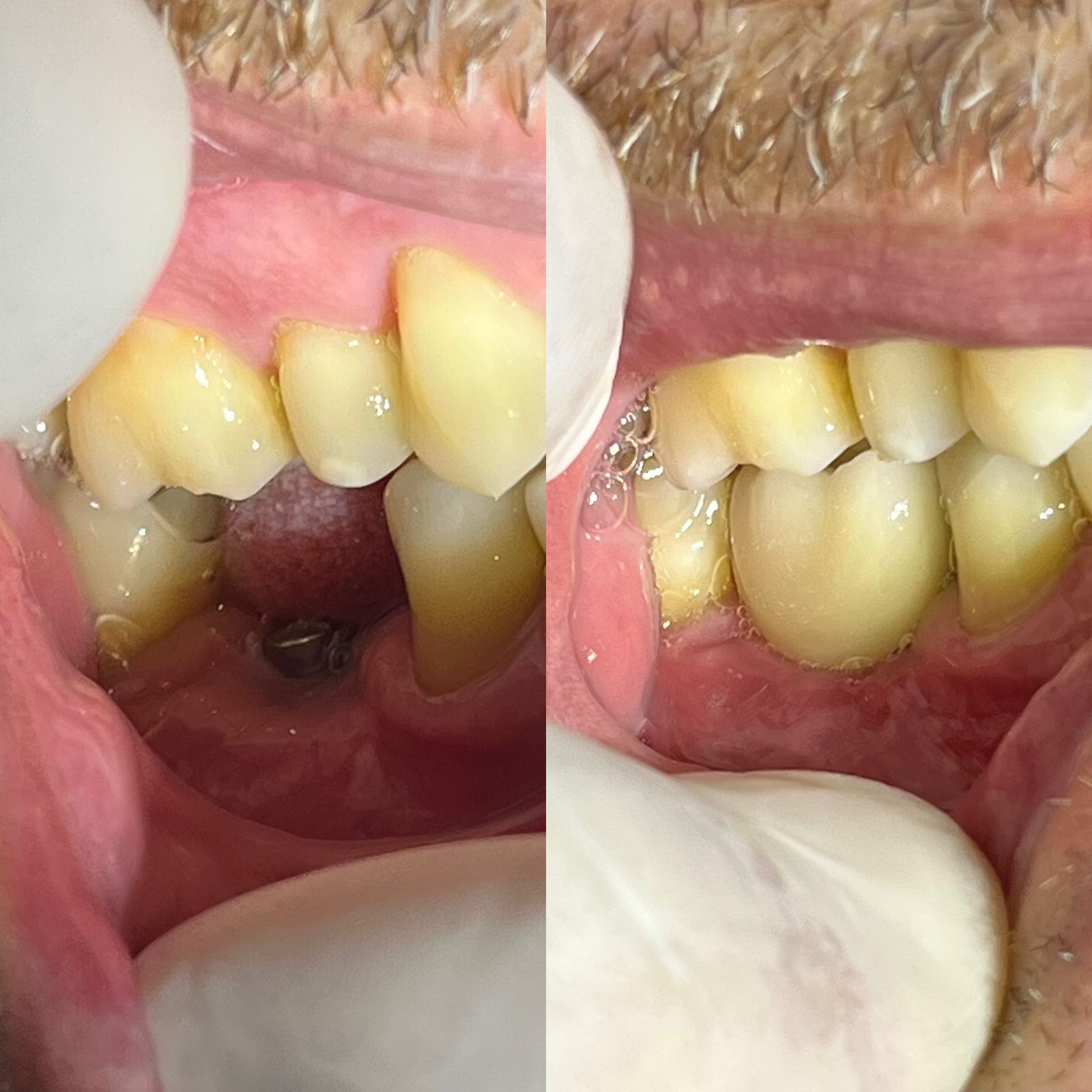 Dr. Douglas Moura - Resultados de tratamentos - 23